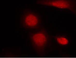 Immunofluorescence staining of methanol fixed HeLa cells staining Androgen Receptor (Phospho-Ser213) with ab131346 antibody at a dilution of 1/100.