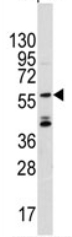 Anti-ANGEL2 antibody (ab71319) at 1/60 dilution + CEM cell line lysates at 35 µg