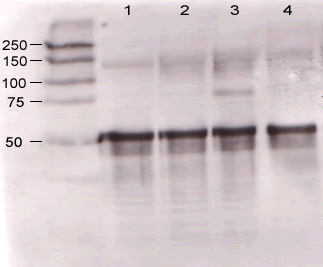 Supernatants of mouse-angiopoietin-expressing endothelial cells.Lane 1 - wt endothelial cell Lane 2 - mouse Ang-1 (clone 1-8) expressing cells Lane 3 - mouse Ang-1 (clone 1-15) expressing cells Lane 4 - mouse Ang-2 (clone 2-9) expressing cells Marion Scharpfenecker 2002