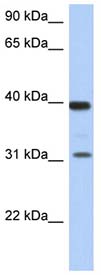 Anti-67kDa Laminin Receptor antibody (ab90073) at 1 µg/ml (in 5% skim milk / PBS buffer) + Human fetal thymus lysate at 10 µgSecondaryHRP conjugated anti-Rabbit IgG at 1/50000 dilution