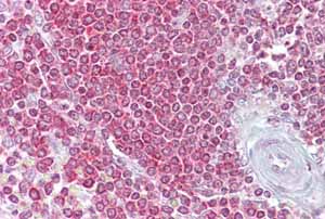 Immunohistochemistry (Formalin/PFA-fixed paraffin-embedded sections) analysis of human spleen tissue labelling 67kDa Laminin Receptor with ab90073 at 5µg/ml.