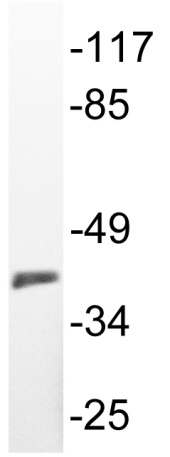 Anti-67kDa Laminin Receptor antibody (ab135471) at 1/500 dilution + K562 cell extract at 30 µg
