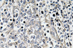 Immunohistochemical analysis of Paraffin-embedded Human tonsil tissue labelling 67kDa Laminin Receptor with ab135471 at 1/50 dilution.