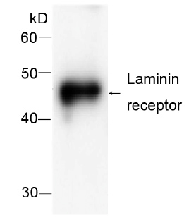 Anti-67kDa Laminin Receptor antibody [39] (ab80657) at 1/1000 dilution + recombinant protein