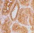 ab15348 at 2µg/ml staining Angiotensin Converting Enzyme 2 in human kidney by IHC