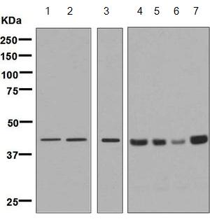 All lanes : Anti-67kDa Laminin Receptor antibody [EPR8468] (ab133775) at 1/1000 dilutionLane 1 : K562 cell lysateLane 2 : HeLa cell lysateLane 3 : HepG2 cell lysateLane 4 : C6 cell lysateLane 5 : RAW 264.7 cell lysateLane 6 : PC12 cell lysateLane 7 : NIH/3T3 cell lysateLysates/proteins at 10 µg per lane.SecondaryHRP labelled Goat anti Rabbit IgG at 1/2000 dilution