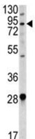 Anti-Angiotensin Converting Enzyme 2 antibody (ab189168) at 1/1000 dilution + HL60 cell lysate at 35 µg