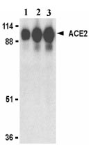 Lane 1 :  Anti-Angiotensin Converting Enzyme 2 antibody (ab15347) at 0.5 µg/mlLane 2 :  Anti-Angiotensin Converting Enzyme 2 antibody (ab15347) at 1 µg/mlLane 3 :  Anti-Angiotensin Converting Enzyme 2 antibody (ab15347) at 2 µg/mlLane 1 : Human kidney lysateLane 2 : Human kidney lysateLane 3 : Human kidney lysate