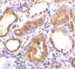 ab15347 at 2µg/ml staining Angiotensin Converting Enzyme 2 by IHC
