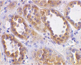 ab15350 at 2µg/ml staining Angiotensin Converting Enzyme 2 in human kidney cells by IHC