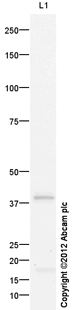 Anti-Angiotensin II Type 1 Receptor antibody (ab97571) at 1 µg/ml (Milk Blocked 3%) + Liver (Mouse) Tissue Lysate at 20 µgSecondaryGoat Anti-Rabbit IgG H&L (HRP) preadsorbed (ab97080) at 1/5000 dilutiondeveloped using the ECL techniquePerformed under reducing conditions.