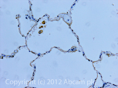 IHC image of Angiotensin II Type 1 Receptor staining in Human normal lung formalin fixed paraffin embedded tissue section, performed on a Leica BondTM system using the standard protocol F. The section was pre-treated using heat mediated antigen retrieval with sodium citrate buffer (pH6, epitope retrieval solution 1) for 20 mins. The section was then incubated with ab97571, 10µg/ml, for 15 mins at room temperature and detected using an HRP conjugated compact polymer system. DAB was used as the chromogen. The section was then counterstained with haematoxylin and mounted with DPX.For other IHC staining systems (automated and non-automated) customers should optimize variable parameters such as antigen retrieval conditions, primary antibody concentration and antibody incubation times.