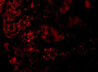 Immunofluorescence of AGTR1 in Mouse Kidney cells using ab124505 at 20 ug/ml.