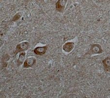 ab9391 staining Angiotensin II Type 1 Receptor in human brain tissue by Immunohistochemistry (Formalin/PFA-fixed paraffin-embedded sections). Tissue was fixed with formaldehyde and a heat mediated antigen retrieval step was performed for 10 minutes using EDTA/ microwave. Samples were then blocked with 1% serum for 20 minutes followed by incubation with the primary antibody at a 1/200 dilution for 18 hours. An HRP-conjugated horse secondary was used at a 1/50 dilution.