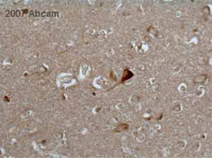 ab19134 at 1/2000 staining human brain tissue sections by IHC-P. The tissue was formaldehyde fixed and blocked with serum prior to incubation with the antibody for 18 hours. An HRP conjugated horse polyclonal antibody was used as the secondary. See Abreview