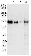 All lanes : Anti-Anillin antibody (ab99352) at 0.04 µg/mlLane 1 : HeLa whole cell lysate at 50 µgLane 2 : HeLa whole cell lysate at 15 µgLane 3 : HeLa whole cell lysate at 5 µgLane 4 : 293T cell lysate at 50 µgdeveloped using the ECL technique