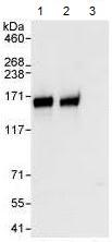 Detection of Human Anillin by Western Blot and Immunoprecipitation. Samples: Whole cell lysate from HeLa (1 mg for IP, 20% of IP loaded). ab99352 used for WB at 1 µg/ml and used for IP at 3 µg/mg lysate (lane 1). Anillin was also immunoprecipitated by another rabbit anti-Anillin antibody (lane 2) and control IgG (lane 3). Detection Chemiluminescence with exposure times of 3 seconds
