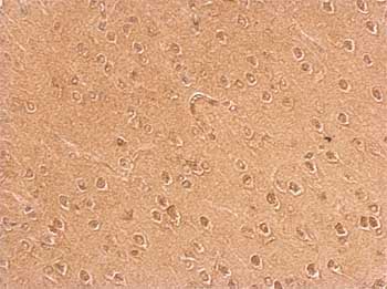 Immunohistochemical analysis of Paraffin-embedded Mouse brain tissue, labeling Anillin with ab154337 at 1/500 dilution.