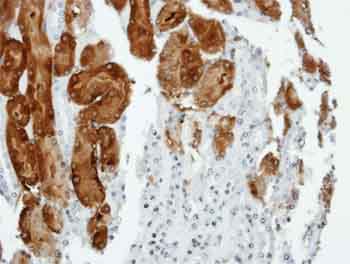 Immunohistochemical analysis of paraffin-embedded Human Kidney tissue, labeling Anillin with ab154337 at 1/100 dilution.
