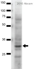 Anti-67kDa Laminin Receptor antibody [MLuC5] (ab3099) at 1/1000 dilution + Mouse pancreatic cancer tissue lysate at 35 µgSecondaryHRP-conjugated Sheep anti-Mouse polyclonal at 1/2000 dilutiondeveloped using the ECL techniquePerformed under reducing conditions.
