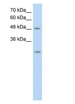 Anti-ANKRD2 antibody (ab59694) at 0.25 µg/ml + HepG2 cell lysate at 10 µgSecondaryHRP conjugated anti-Rabbit IgG at 1/50000 dilution