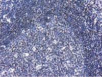 ab124035, at 1/150 dilution, staining ANKRD53 in paraffin-embedded Human lymph node tissue by Immunohistochemistry.