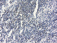 ab124035, at 1/150 dilution, staining ANKRD53 in paraffin-embedded Human lymphoma tissue by Immunohistochemistry.