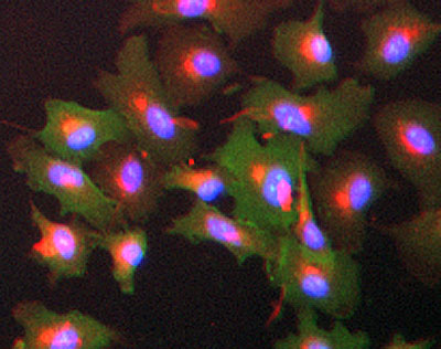 ICC/IF image of ab47661 stained A549 cells. The cells were 100% methanol fixed (5 min) and then incubated in 1%BSA / 10% normal goat serum / 0.3M glycine in 0.1% PBS-Tween for 1h to permeabilise the cells and block non-specific protein-protein interactions. The cells were then incubated with the antibody (ab47661, 5µg/ml) overnight at +4°C. The secondary antibody (green) was ab96899, DyLight® 488 goat anti-rabbit IgG (H+L) used at a 1/250 dilution for 1h. Alexa Fluor® 594 WGA was used to label plasma membranes (red) at a 1/200 dilution for 1h. DAPI was used to stain the cell nuclei (blue) at a concentration of 1.43µM.