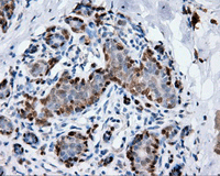 ab118060 at 1/50 dilution staining Annexin A1 in Paraffin-embedded Human Breast tissue by Immunohistochemistry.