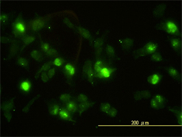 Annexin II antibody (ab54771) used in immunofluorescence at 10ug/ml on HeLa cells.