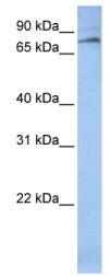 Anti-12 Lipoxygenase antibody (ab84959) at 1 µg/ml (in 5% skim milk / PBS buffer) + Human fetal brain lysate at 10 µgSecondaryHRP conjugated anti-Rabbit IgG at 1/50000 dilution