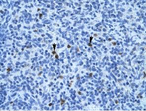 Immunohistochemistry (Formalin/PFA-fixed paraffin-embedded sections) analysis of human spleen tissue labelling Annexin A3 with ab33068 at 4µg/ml. Positively labelled cells indicated by arrows. Magnification: 400X.