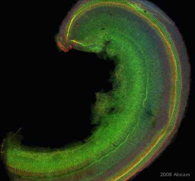 ab14196 staining cells from a mouse organ of Corti (whole mount) by ICC/IF.  The tissue was PFA fixed and permeabilized in 0.5% Triton X-100 prior to blocking in 5% goat serum, 2% BSA for 1 hour at 25°C.  The primary antibody was diluted 1/200 and incubated with the sample for 2 hours at 25°C.  A Cy3® conjugated sheep anti-rabbit IgG antibody, diluted 1/200 was used as the secondary. Alexa Fluor 488® - Phalloidin was used to label the actin cytoskeleton and DAPI was used to label nuclei.See Abreview