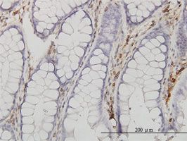 Annexin V antibody (ab54775) used in immunohistochemistry at 3ug/ml on formalin fixed and paraffin embedded human colon.