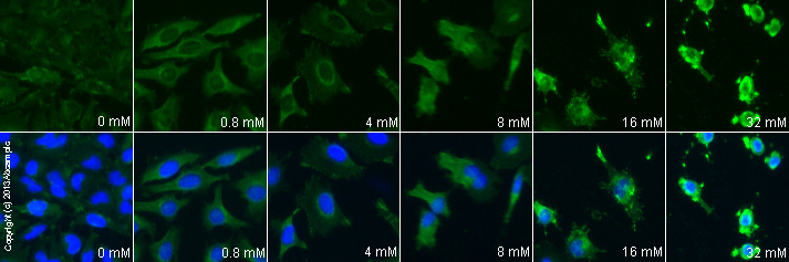 ab54775 staining annexin V in HeLa cells treated with pentoxifylline (ab120725), by ICC/IF. Increase of annexin V correlates with increased concentration of pentoxifylline, as described in literature.The cells were incubated at 37°C for 24h in media containing different concentrations of ab120725 (pentoxifylline) in DMSO, fixed with 4% formaldehyde for 10 minutes at room temperature and blocked with PBS containing 10% goat serum, 0.3 M glycine, 1% BSA and 0.1% tween for 2h at room temperature. Staining of the treated cells with ab54775 (10 µg/ml) was performed overnight at 4°C in PBS containing 1% BSA and 0.1% tween. A DyLight 488 goat anti-mouse polyclonal antibody (ab96879) at 1/250 dilution was used as the secondary antibody. Nuclei were counterstained with DAPI and are shown in blue.