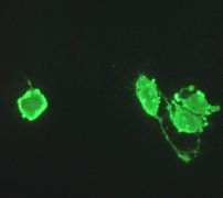 Immunofluorescent staining of staurosporin-treated apoptotic HeLa cells using 1/250 ab108194.