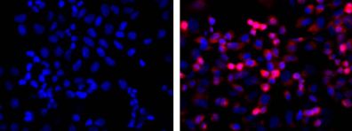 Immunofluorescence (red) with ab18184 on His-tag fusion protein in 293 cells.Left hand panel: untransfected controlRight hand panel: transfected.Counterstained with DAPI (blue).