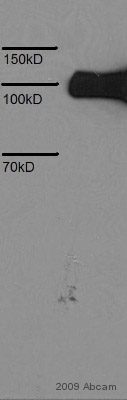 Anti-6X His tag® antibody [HIS.H8] (ab18184) at 1/5000 dilution + Conditioned medium from transfected HEK293 cells which produce recombinant secretory protein with a 6XHis-Tag at 5 µgSecondaryAn HRP-conjugated Horse anti mouse polyclonal at 1/5000 dilutionThis image is courtesy of an anonymous AbreviewSee Abreview