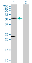 All lanes : Anti-Antizyme inhibitor 1 antibody (ab169605) at 1 µg/mlLane 1 : Antizyme inhibitor 1 transfected 293T cell lysateLane 2 : Non-transfected 293T cell lysateLysates/proteins at 15 µl per lane.SecondaryGoat Anti-Rabbit IgG (H+L)-HRP at 1/7500 dilutiondeveloped using the ECL technique