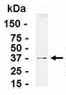 Anti-ANXA9 antibody (ab37501) at 1/2000 dilution + E. coli-derived fusion proteinSecondaryGoat anti-IgY-HRP at 1/1000 dilution