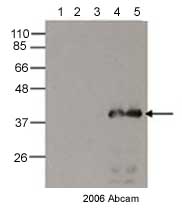 All lanes : Anti-6X His tag® antibody - ChIP Grade (ab9108) at 1/1000 dilutionLane 1 : 10ug non-transformed lysateLane 2 : 10ug non-transformed lysate + 1mM IPTGLane 3 : 10ug E.coli Lysate harbouring His-tag-RelA NTD, non-inducedLane 4 : 10ug Induction of His-tag RelA NTD 1 mM IPTGLane 5 : 10ug Induction of His-tag RelA NTD 1 mM IPTGSecondaryHRP conjugated goat anti-rabbit IgGdeveloped using the ECL techniquePerformed under reducing conditions.Observed band size : 37 kDa (why is the actual band size different from the predicted?)Additional bands at : 12 kDa (possible non-specific binding).Exposure time :  1 minuteThis image is courtesy of an Abreview.See Abreview