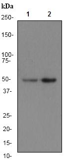 All lanes : Anti-AP2M1 antibody [EP2695Y] (ab75995) at 1/1000 dilutionLane 1 : MCF-7 cell lysateLane 2 : SKBR-3 cell lysateLysates/proteins at 10 µg per lane.SecondaryHRP labelled goat anti rabbit at 1/2000 dilution