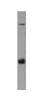 Anti-AP3B2 antibody (ab48269) at 1/500 dilution