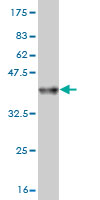 Western blot against tagged recombinant protein immunogen using ab56996 AP4B1 antibody at 1ug/ml.