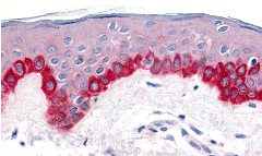 Immunohistochemistry of Apaf1 in human skin tissue with Apaf1 antibody at 20 µg/ml.