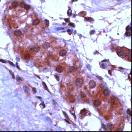 Human testis stained with ab46899 using the antibody at a dilution of 1:200