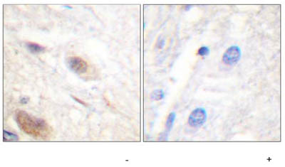 ab59421, at a 1/50 dilution, staining paraffin embedded human brain tissue sections by Immunohistochemistry in the absence (left image) or presence (right image) of the phosphopeptide.