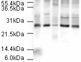 All lanes : Anti-Apc10 antibody (ab3629) at 1/500 dilutionLane 1 : Hela nuclear lysatesLane 2 : Hela cell lysateLane 3 : A431 cell lysateLane 4 : Jurkat cell lysateLane 5 : 293 cell lysateLysates/proteins at 20 µg per lane.SecondaryGoat Anti-Rabbit IgG H&L (HRP) (ab6721) at 1/5000 dilution