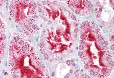 Immunohistochemical analysis of paraffin-embedded, formalin-fixed Human kidney tissue labelling Apc11 with ab133200 at 5 µg/ml, followed by biotinylated secondary antibody, alkaline phosphatase-streptavidin and chromogen.