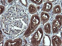Immunohistochemical analysis of paraffin-embedded Human kidney tissue labelling Apc11 with ab140511 at 1/150 dilution.